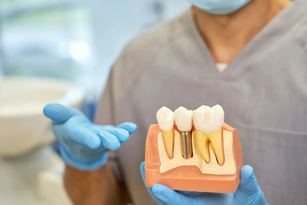 Dental professional holding a model demonstrating a dental implant with crown attached, showing how the implant integrates with surrounding teeth and bone.