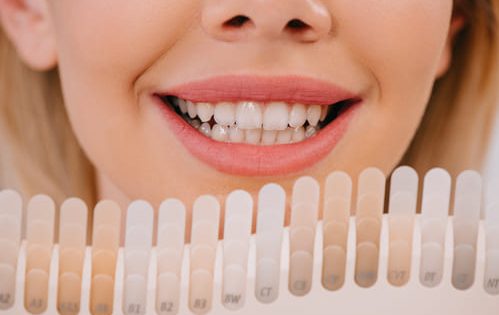 teeth whitening guelph