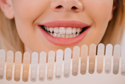 teeth whitening guelph